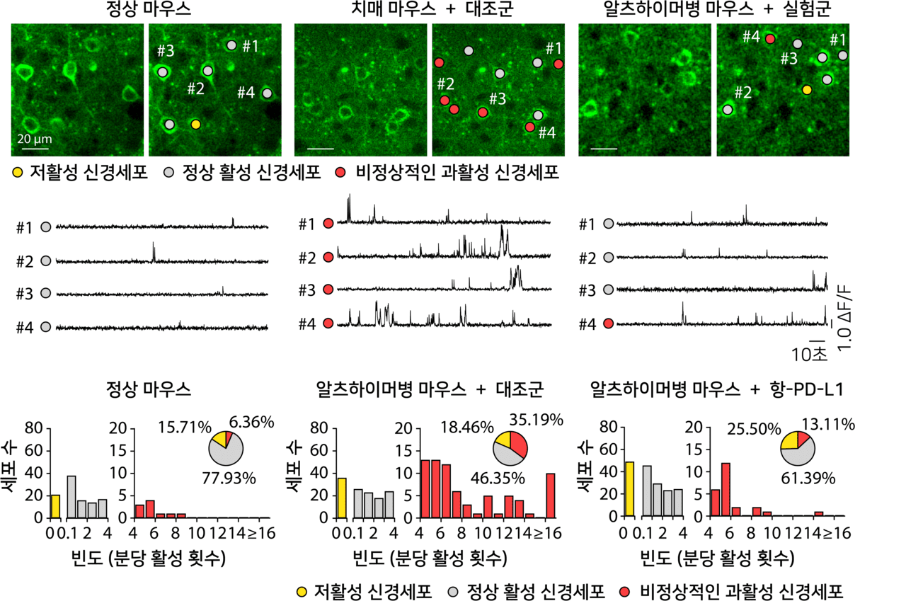 ▲ PD-L1 차단 후 알츠하이머병 마우스에서 신경세포의 비정상적인 과활성이 감소하였음을 보여주는 대표 이미지 및 분석 결과<br>